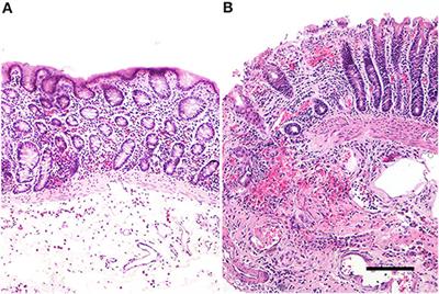 Expression of Proteinase-Activated Receptor 2 During Colon Volvulus in the Horse